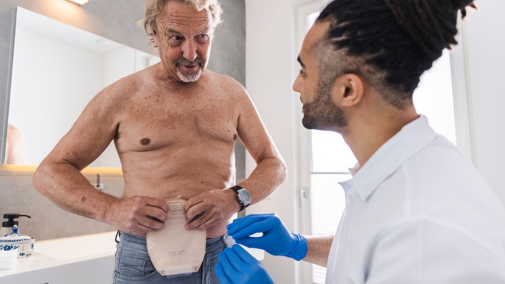 Homme portant une poche de stomie sur le haut du corps nu avec une infirmière masculine portant des gants lui indiquant comment appliquer la poche