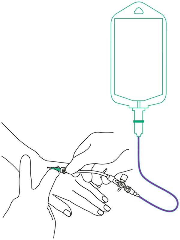 Une goutte de médicament attachée au bras d’un patient