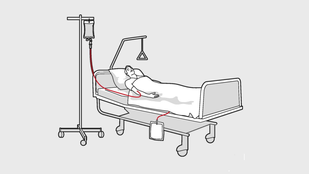 Abbildung einer Person im Krankenhausbett, die eine Infusion erhält
