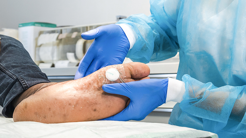 Zwei Hände mit Handschuhen halten einen diabetischen Fuß mit einem Pflaster darauf, im Hintergrund medizinisches Material in einem medizinischen Raum