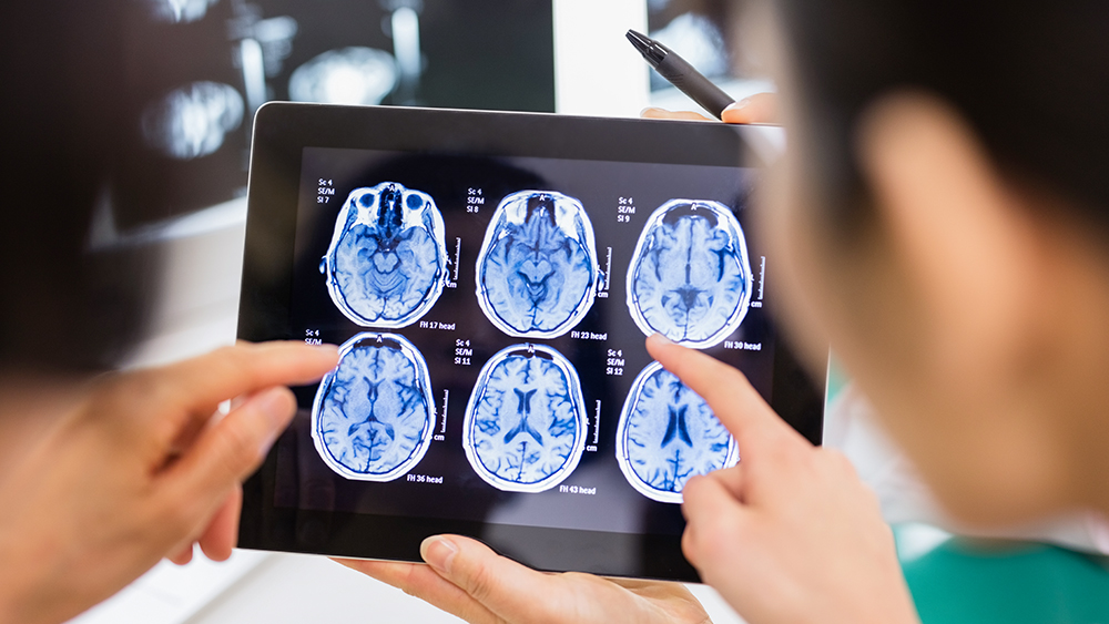 Les médecins examinent une image IRM du cerveau