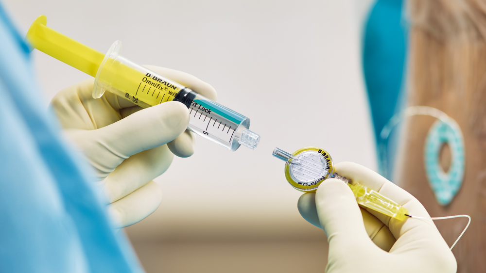Une seringue remplie de médicament est connectée à un filtre doté d’un connecteur spécial pour l’anesthésie régionale.